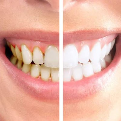 Clean Dental Environment